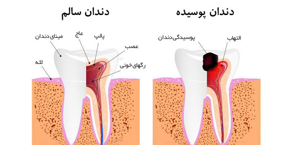 حفظ سلامتی دهان و دندان