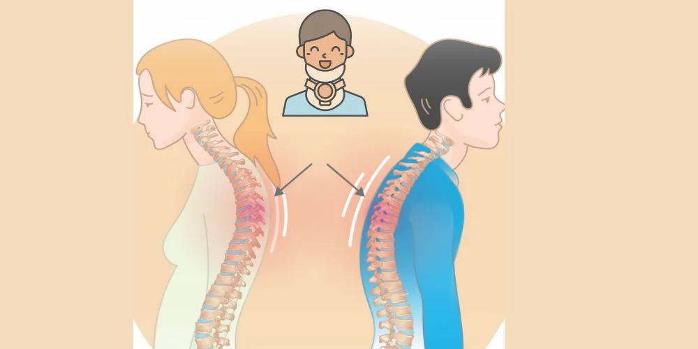 آیا استفاده از گردنبند طبی برای قوز گردن موثر است؟
